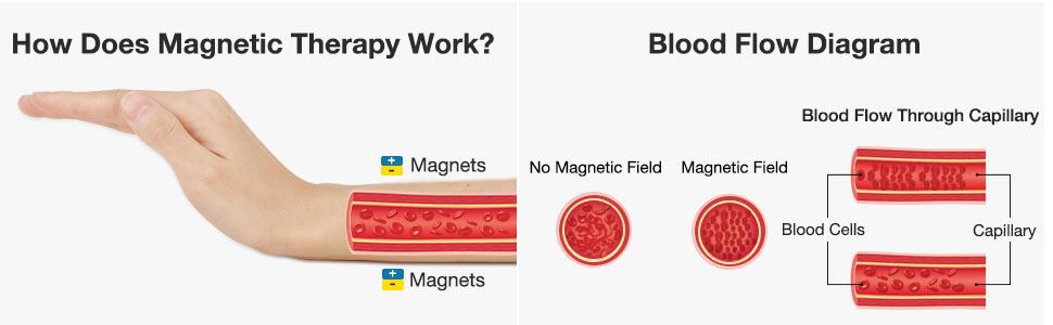 Magnetic Therapy Work